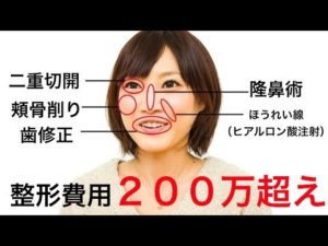 木下ゆうか,猫 投げる,吐きダコ,整形外科,炎上理由,はじめしゃちょー 木下ゆうか,猫 投げる,吐きダコ,整形外科,炎上理由,はじめしゃちょー