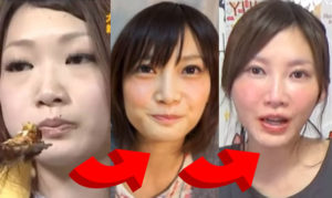 木下ゆうか,猫 投げる,吐きダコ,整形外科,炎上理由,はじめしゃちょー 木下ゆうか,猫 投げる,吐きダコ,整形外科,炎上理由,はじめしゃちょー
